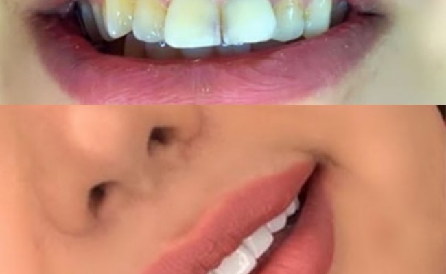 دندانپزشکی و پروتز دندان دکتر رحمانی_سهیلیان